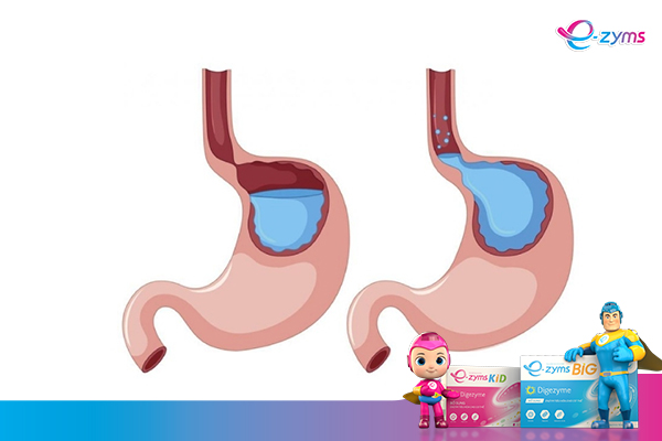 Uống thuốc gì khi bị đầy hơi, chướng bụng?
